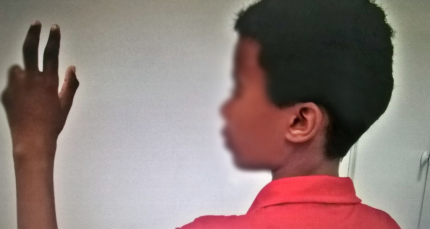 Menino perde dois dedos em acidente de trabalho em feira livre de Aracaju